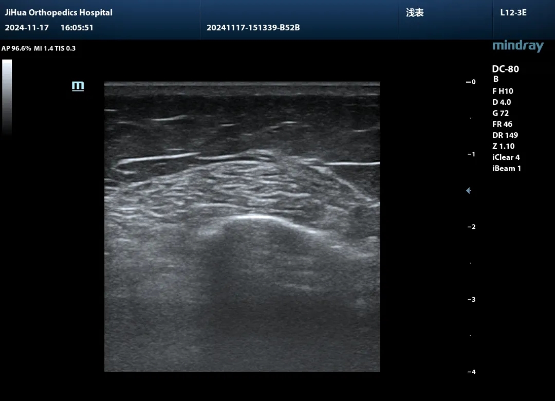 1762409806159494.jpg e5af8aca08a6cca37dac3d10d4c22dfd.jpg